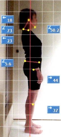 歪み/内臓/自律神経を整える【整体Re:Body!(リボディ)|大阪心斎橋】で自然治癒力UP。-姿勢矯正 整体 心斎橋 難波