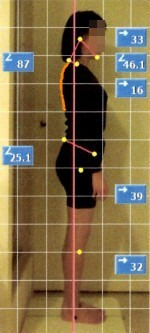 $『歪み』を矯正し『不調』のない生活を。【整体Re:Body!(リボディ)|大阪心斎橋】-姿勢矯正 ビフォーアフター 左近 猫背