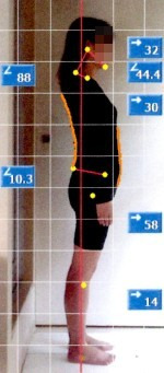 $『歪み』を矯正し『不調』のない生活を。【整体Re:Body!(リボディ)|大阪心斎橋】-姿勢矯正 ビフォーアフター10-1 鎌倉