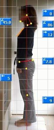 姿勢矯正18　アフター